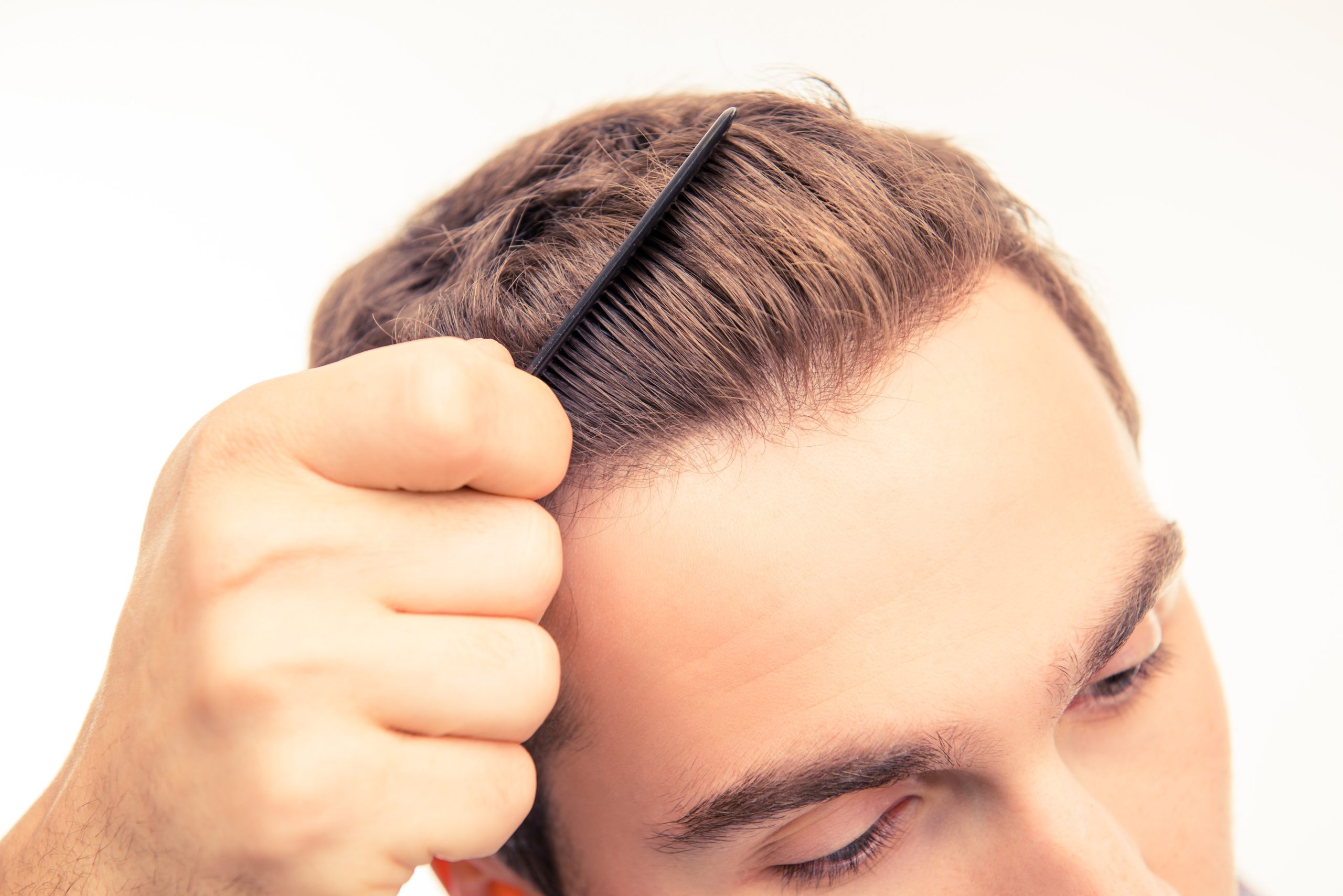 Die beste Haartransplantationsklinik in Istanbul